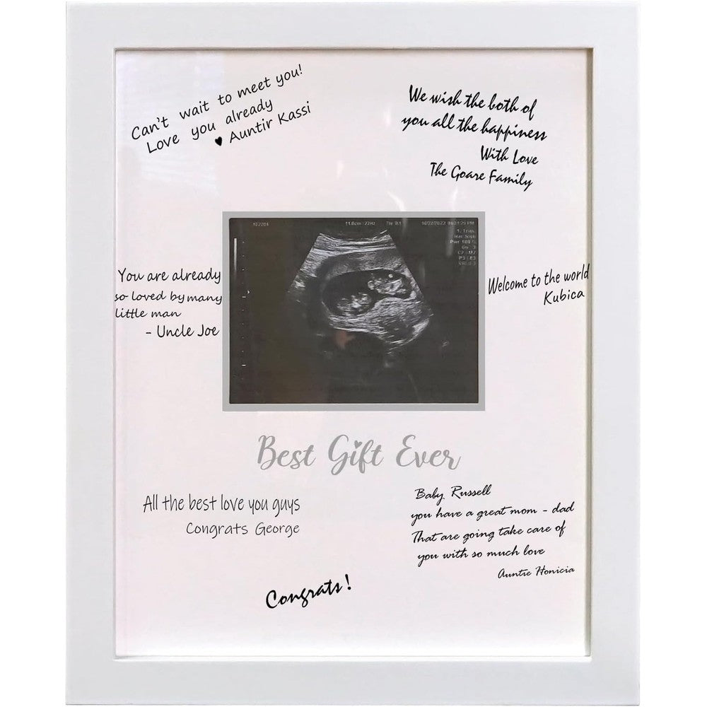 HAMUIERS Sonogram Signature Frame Guest Book front view featuring white wood border and central ultrasound photo opening.