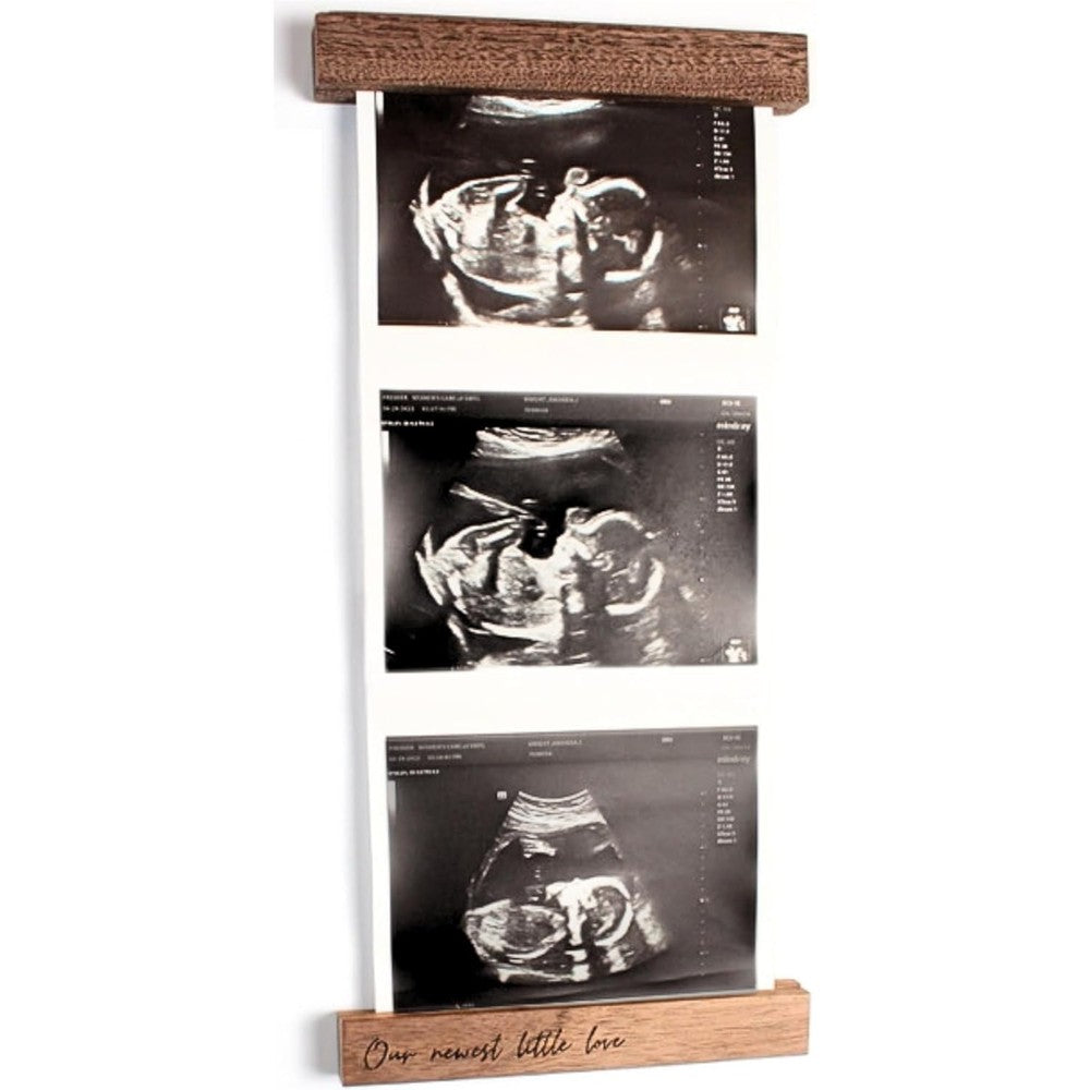 Oscar Bee sonogram picture frame front view crafted from dark walnut wood displaying an ultrasound photo