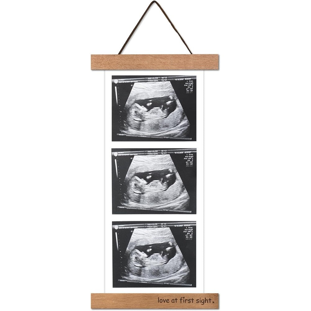Zyeco magnetic ultrasound photo frame front view showing teak wood design.