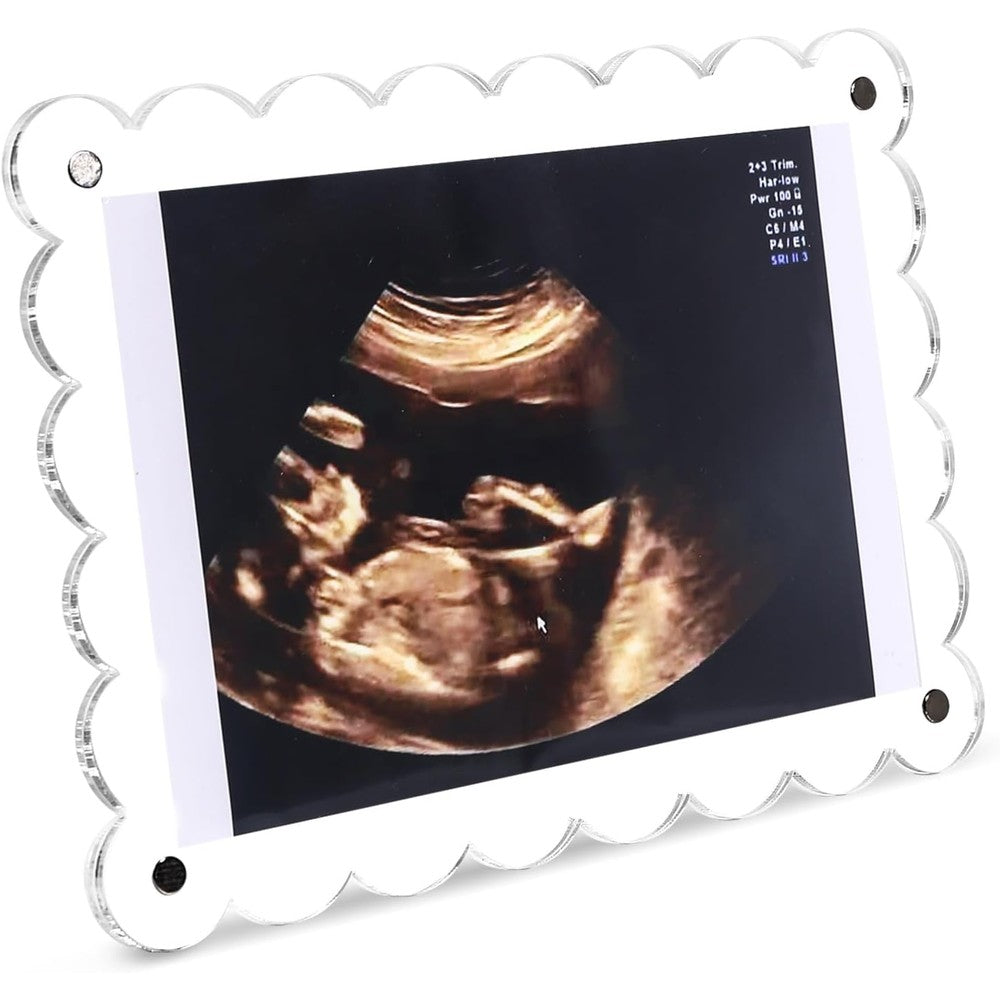 Mlatnod magnetic clear acrylic scalloped baby ultrasound picture frame front view holding a sonogram photo.