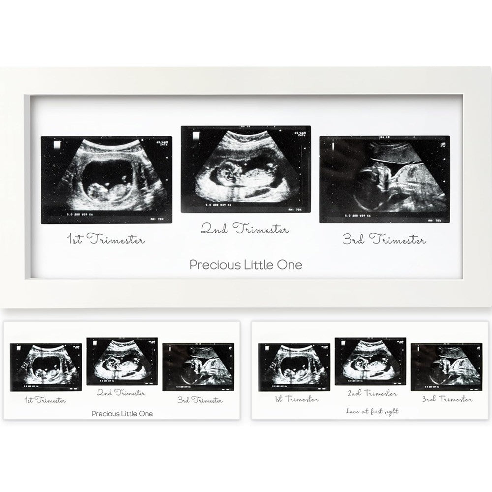KeaBabies trio baby sonogram picture frame alpine white front view
