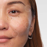 The Ordinary Volufiline 92% target areas - under-eye hollows, cheeks and smile lines for volume loss